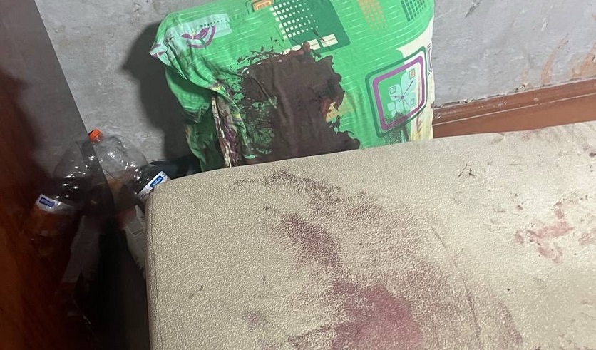 Не поделили бутылку спиртного: в Витебске сожители устроили драку с молотком, женщина тяжело ранена